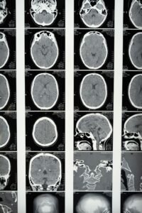 Escaneo de imagen médica del cerebro, neurociencia forense