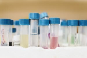 Tubos de ensayo con muestras de laboratorio, toxicología forense